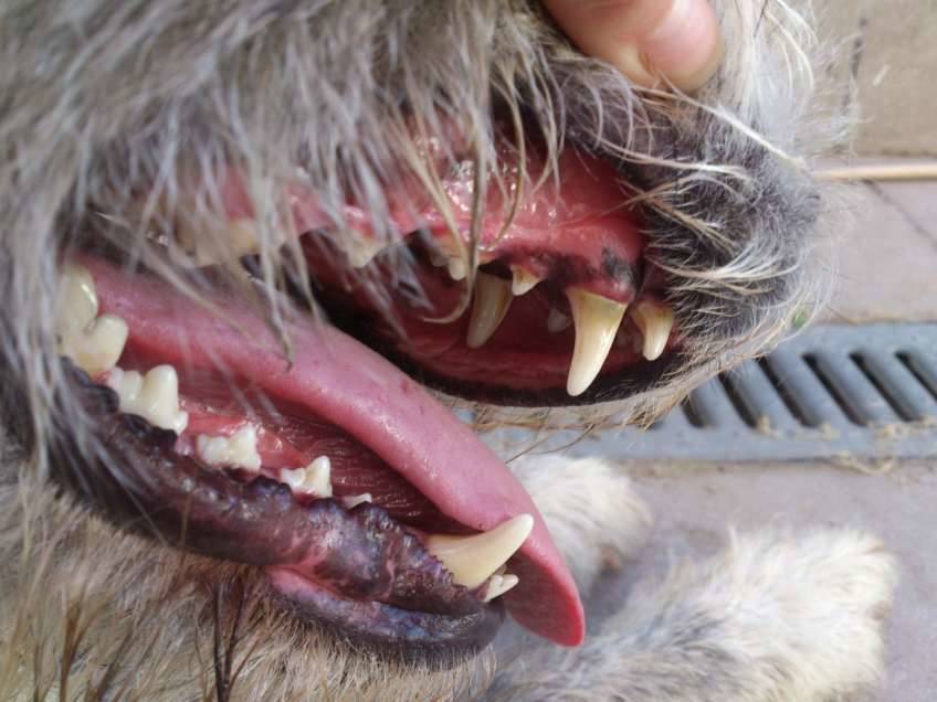 Dientes con sarro